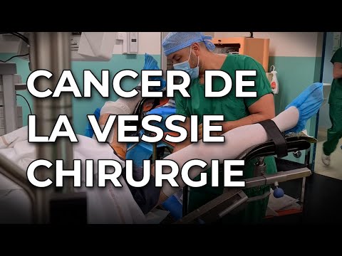 Vidéo: Comment diagnostiquer le cancer de la vessie (avec photos)