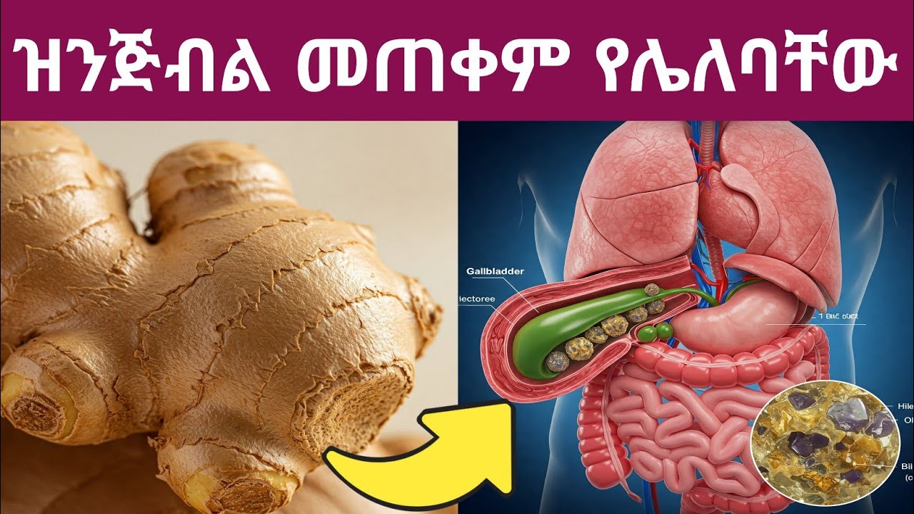 ዝንጅብል በፍፁም መጠቀም የሌለባቸው እና በመጠኑ ብቻ መጠቀም ያለባቸው ሰዎች| Who Should Avoid or Consume Ginger in Moderation