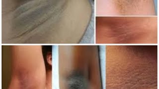 Xusulda Jilbah Kilkisha Madmadoga Iskrb Ufcn