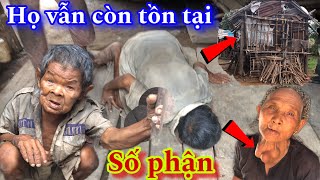 Xót xa cho cả một gia đình có hình dạng kì lạ không thể tin trên đời này vẫn còn tồn tại được #271