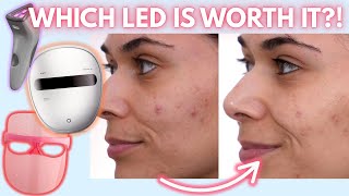 TRIED &amp; TESTED: Which LED Skin Care Device Should You Buy for Acne + Fine Lines?
