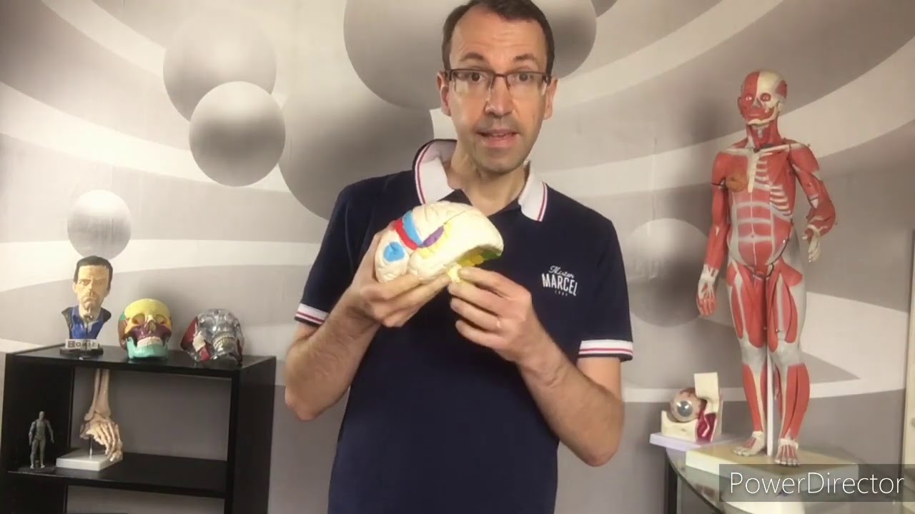 3 raisons pour lesquelles ArTeMiss souffre de maux de tête