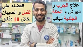 القضاء علي القمل و الصيبان نهائيا خلال 10 دقائق و حشرات الشعر / علاج الجرب و الهرش و الحكة الجلدية