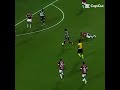 neymar sem cabelo
