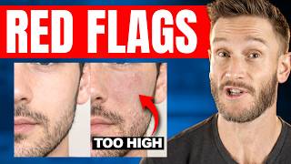 Celebrity If You See This on Your Face, Your Cortisol is Too High (don’t ignore) Net Worth