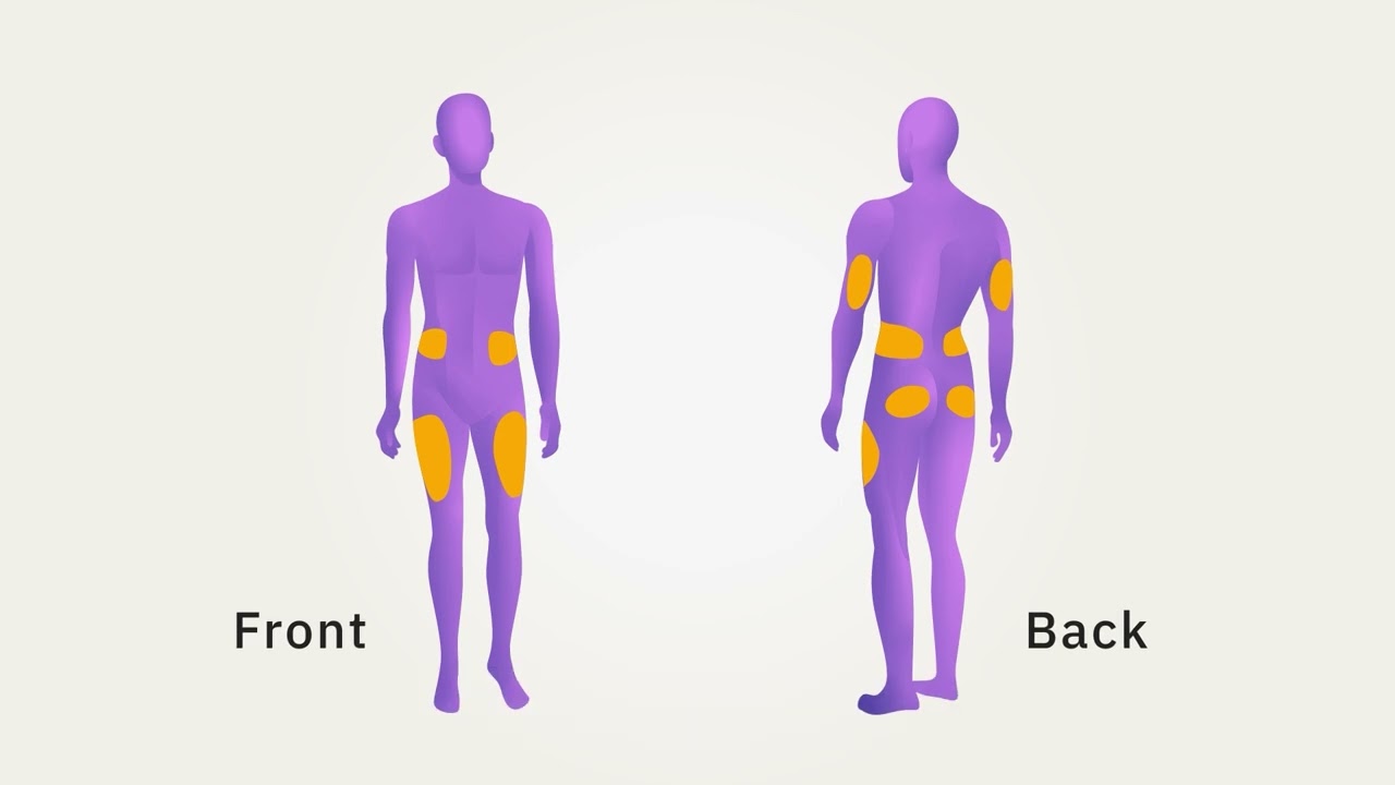 How to Connect Omnipod® 5 to Dexcom G7*