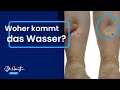 Wasser in den Beinen - Wo kommt das her? | Dr. Heart