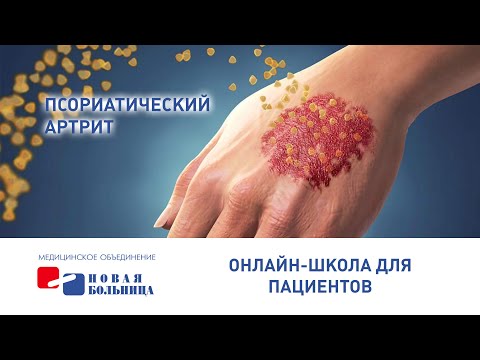 Видео: 14 естественных методов лечения псориатического артрита: куркума и многое другое