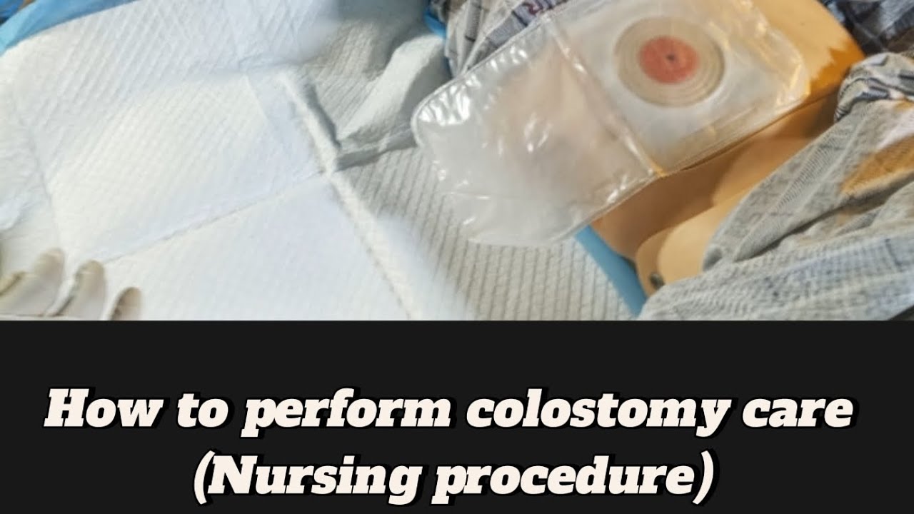 How to perform colostomy care (Nursing procedure)
