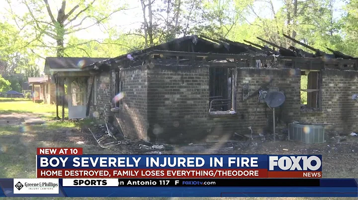 Theodore boy severely injured in house fire
