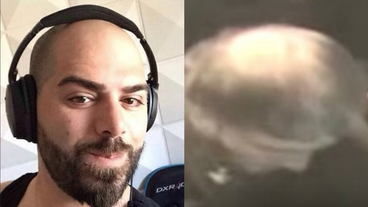 Faze Banks Bald Faze Banks Bald