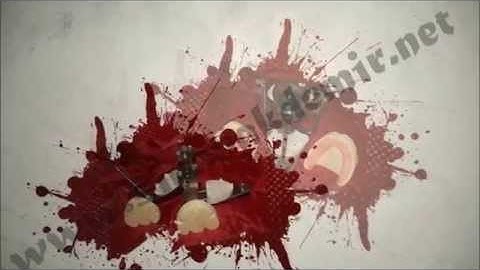 Lingualize Occlusion