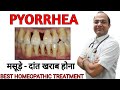 Pyorrhoea । जिंजिवायटिस । gingivitis । gums ।हैलिटोसिस