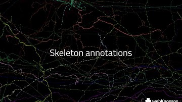 webKnossos - Skeleton annotations