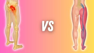 Sciatica or Piriformis Syndrome: How to Tell the Difference