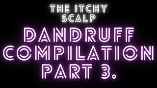 Best of The Itchy Scalp Part 3. | Dandruff Compilation