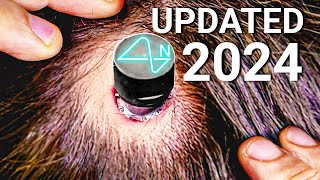 The 2024 Neuralink Update Is Here!