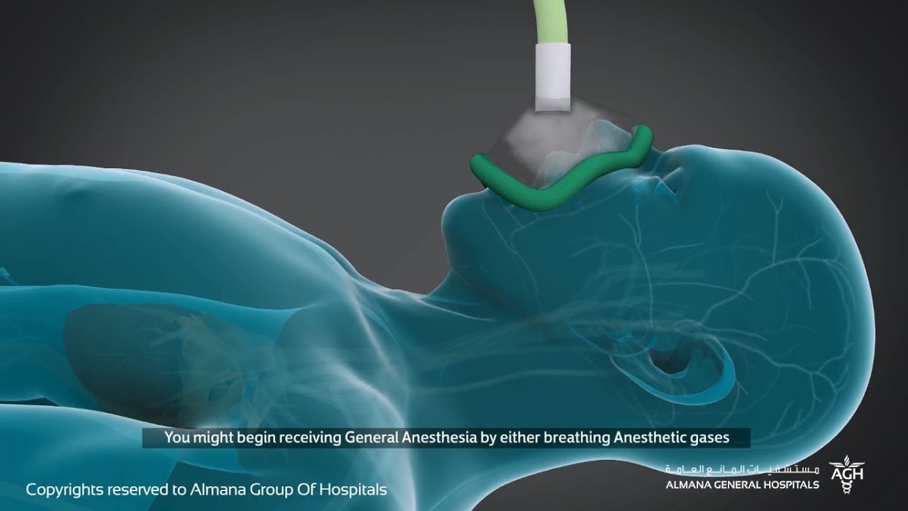 كيف يعمل التخدير العام؟