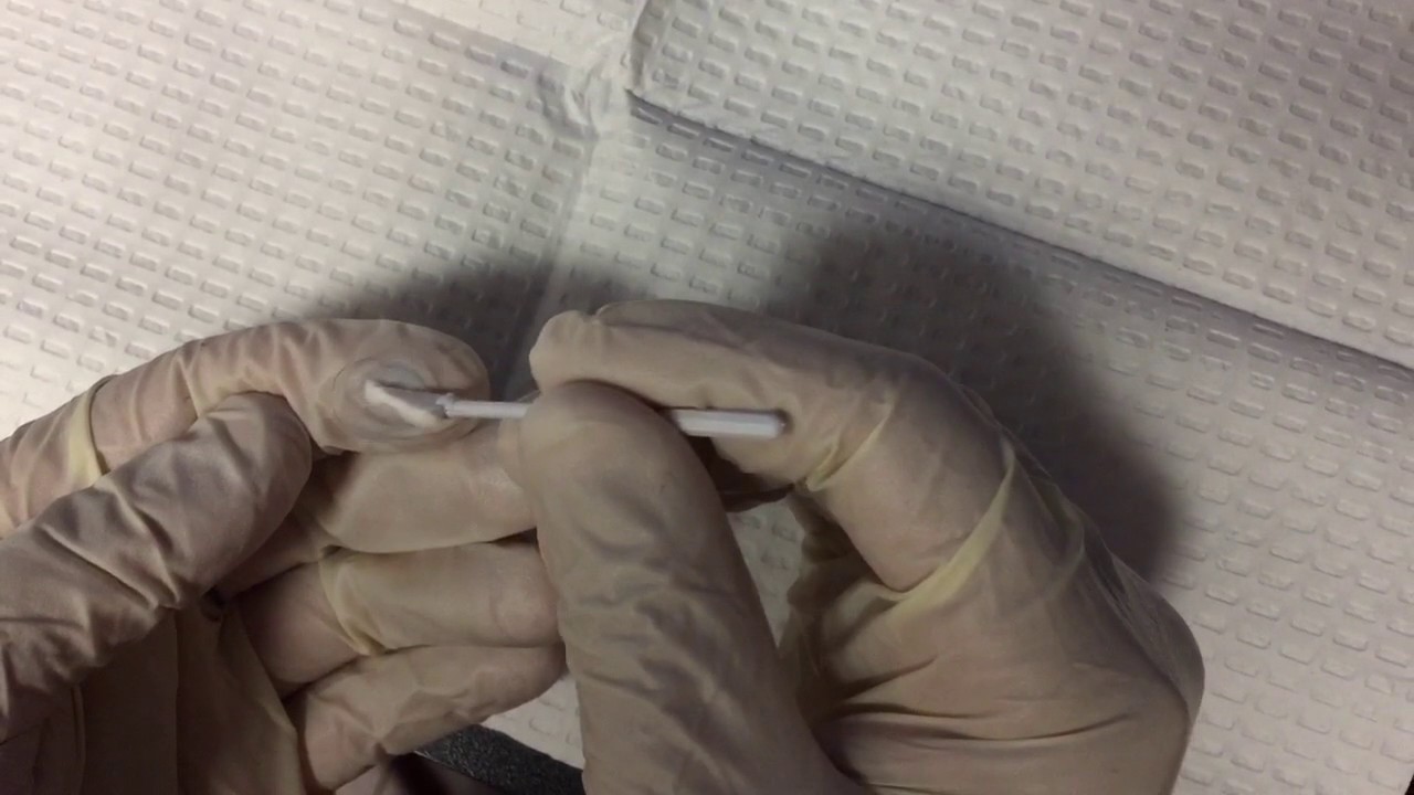 Applying BioD amniotic membrane directly on contact - YouTube