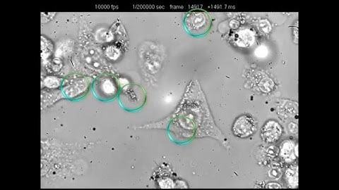 Microbubbles and cells interaction under high-speed microscopy