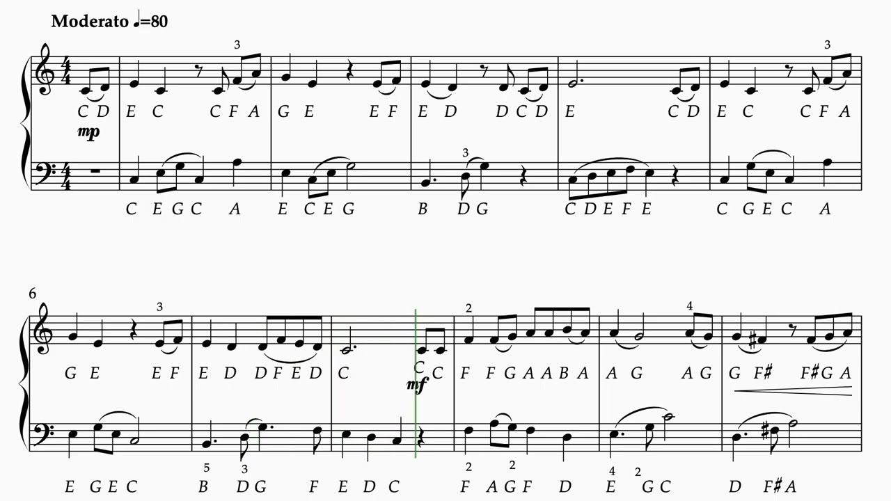 Singapura, Oh! Singapura prepared for Special needs players