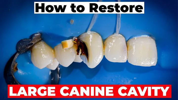 How to Restore a Large Canine Cavity | Restorative Dentistry with Dr. Lincoln Harris