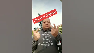 I Have 11 Fingers 