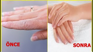 Kuru Çatlayan Ve Yıpranmış Ellere 5 Dakikada Etkili Çözüm Resimi