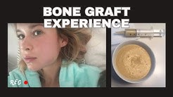 Bone graft | My EXPERIENCE 