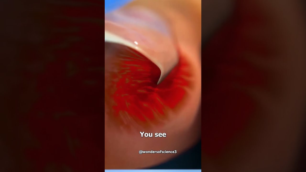 How To Cut Nails Properly Nail Cutting Cuttingskills Avoid Infection