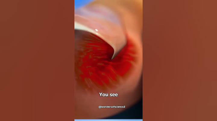 How to cut nails properly | nail cutting #nails #cuttingskills #properly #to #avoid #infection