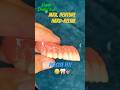 Denture Reline #howto#dental#dentist#cesar#satisfying#fyp#shorts#diy#feed#reels#yt#oc#dentadura#tpd