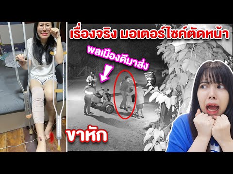 เรื่องจริง พี่แสง โดนรถชน ขาหัก เดินไม่ได้เข้าโรงพยาบาล
