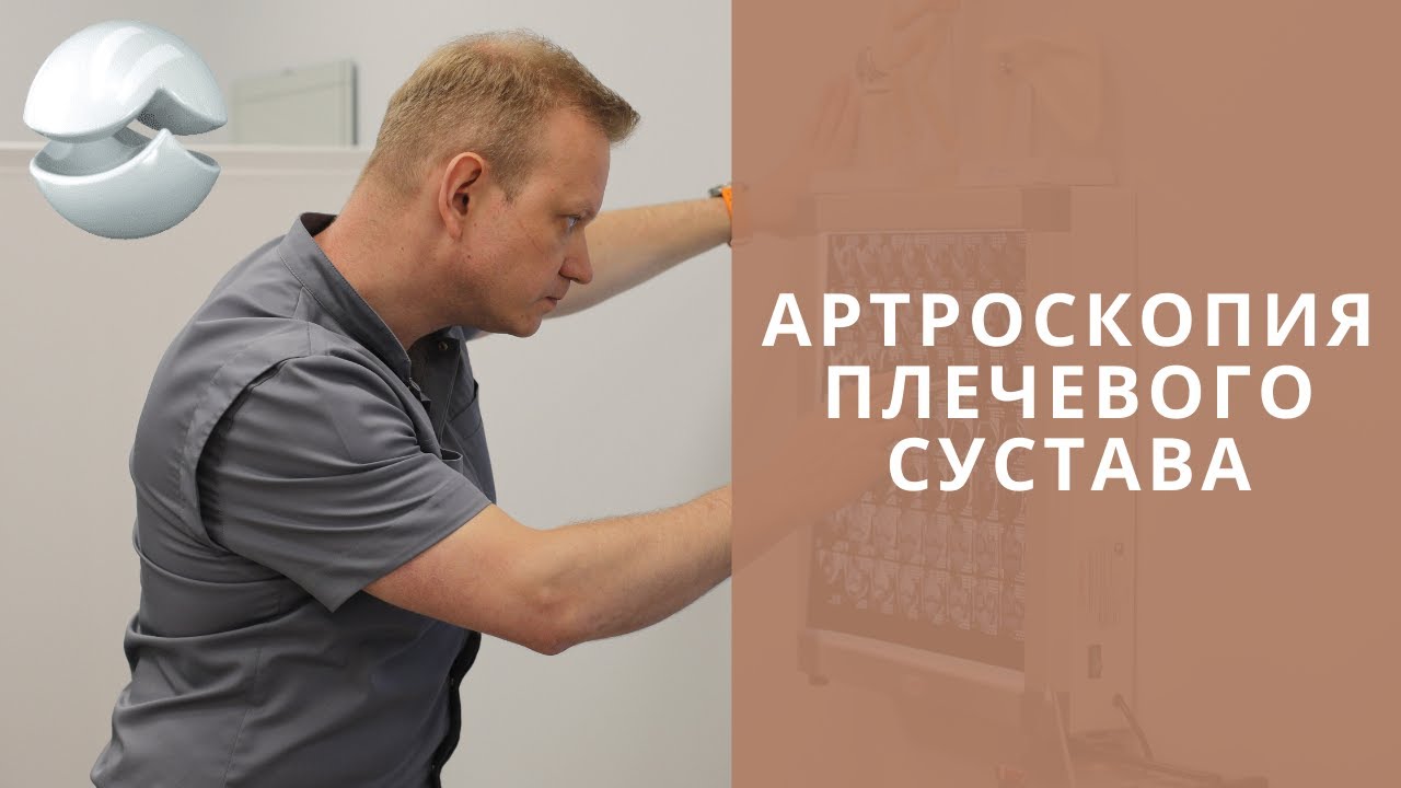 Артроскопия плечевого сустава