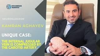 Unique Case: Internal Jugular Vein Compression by the Carotid Artery | Dr. Kamran Aghayev