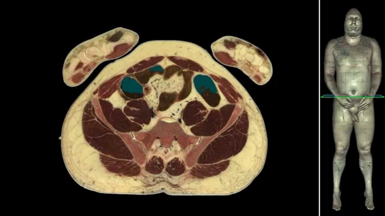 Anatomy internal organs human body. - YouTube