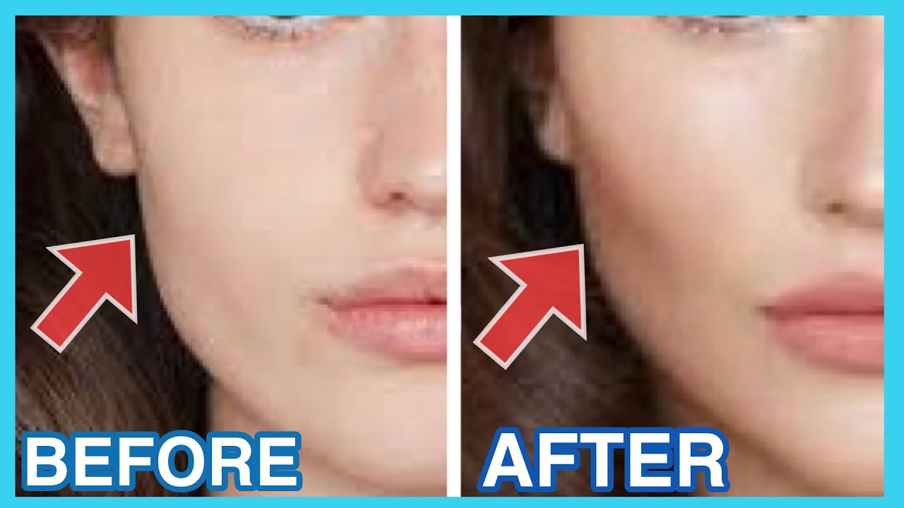 Get High Cheekbones Naturally With This Massage & Exercise | Beautiful Cheekbones