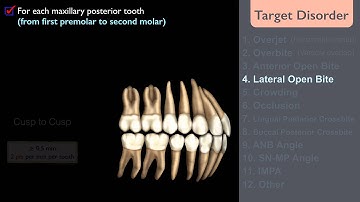 CC359. Discrepancy Index (DI) Part 1