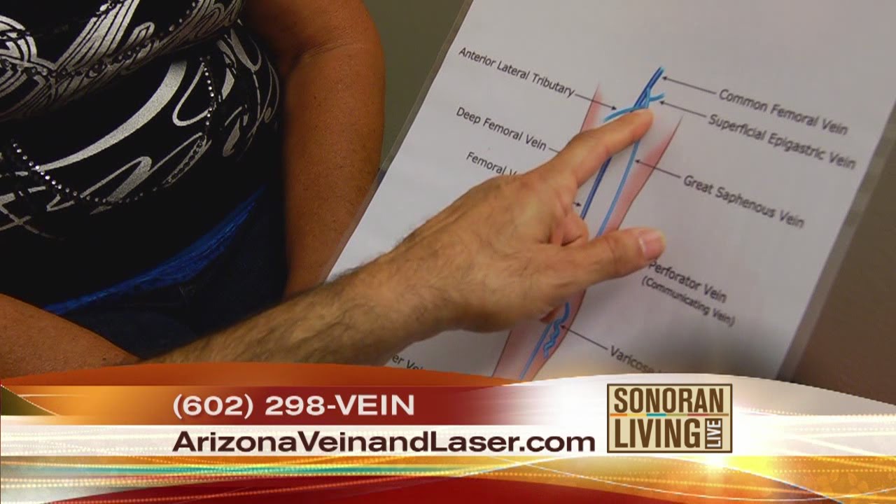Got vein pain? Get relief from AZ Vein and Laser