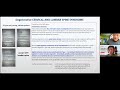 GDT online practical session held on 29 November 2022 on Upper Limbs