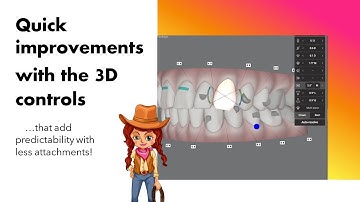 Invisalign ClinCheck edited and made easier with the 3D controls