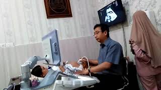 Usg kandungan usia 5bln, sudah kelihatan semua. Positif jenis kelamin laki2.