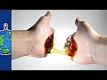 Sugar Properties and Historical Context