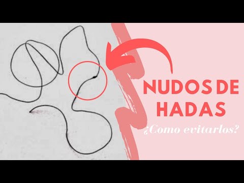 Vídeo: ¿Por Qué Algunos Tienen Nudillos En El Pelo Y Cómo Eliminarlo?