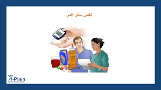 نقص سكر الدم