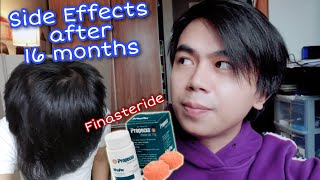 FINASTERIDE 16 months update for HAIR LOSS | SIDE EFFECTS