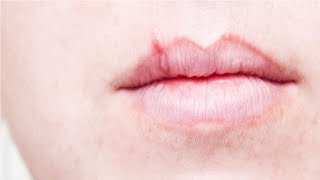 how to get rid of a cold sore scab overnight