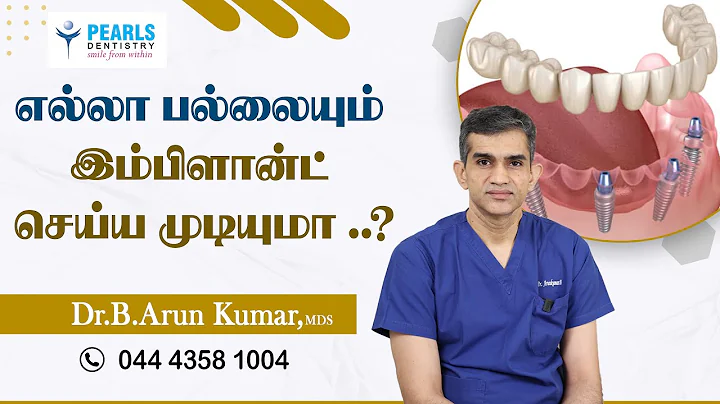 Can you implant your full mouth..? -  Pearls Dentistry - Dr.Arun Kumar