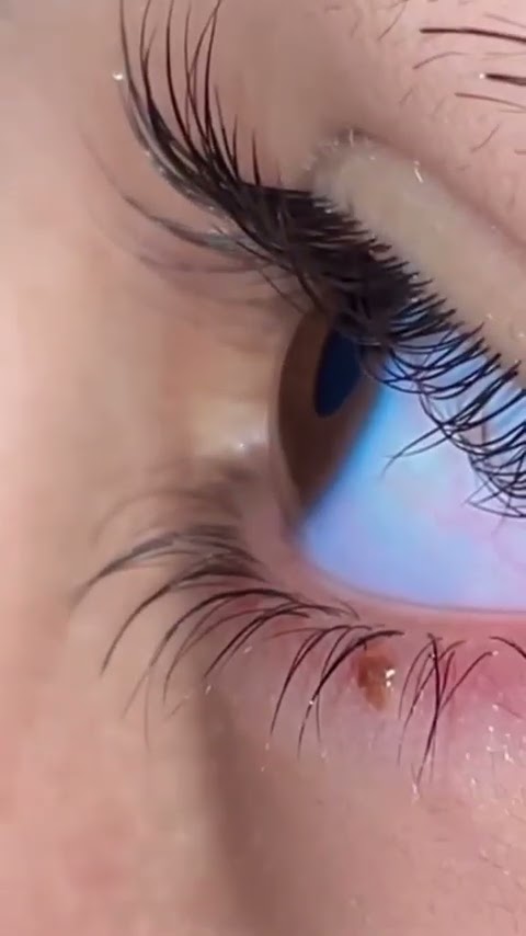 EYELASH SERUM THAT YOU MUST TRY😠#shorts #short #poisonshopping #youtubeshorts