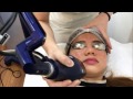 How I clear up my skin - Q-switched laser and shining peel
